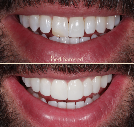 Smile Gallery - Castle Street Dental Practice