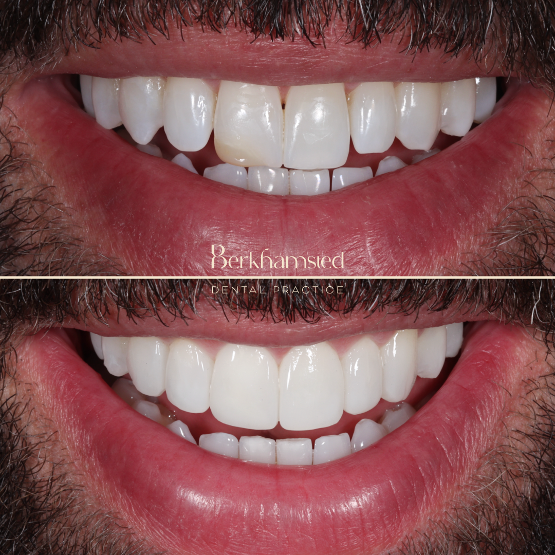 Smile Gallery - Castle Street Dental Practice