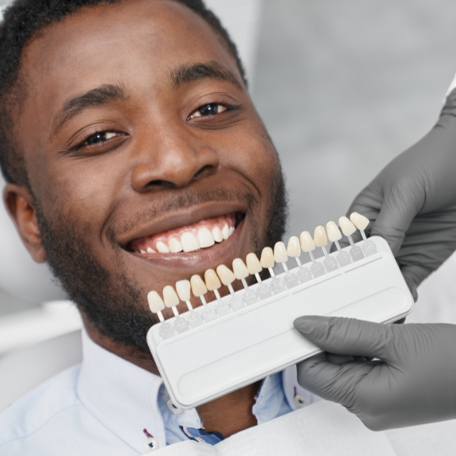 Veneers